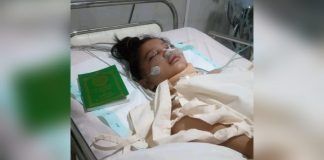 Gadis Belia Mengalami Pembekuaan Darah di Otak dan Perenggangan Tulang Butuh Bantuan